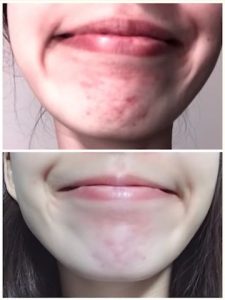 ビフォーアフター写真